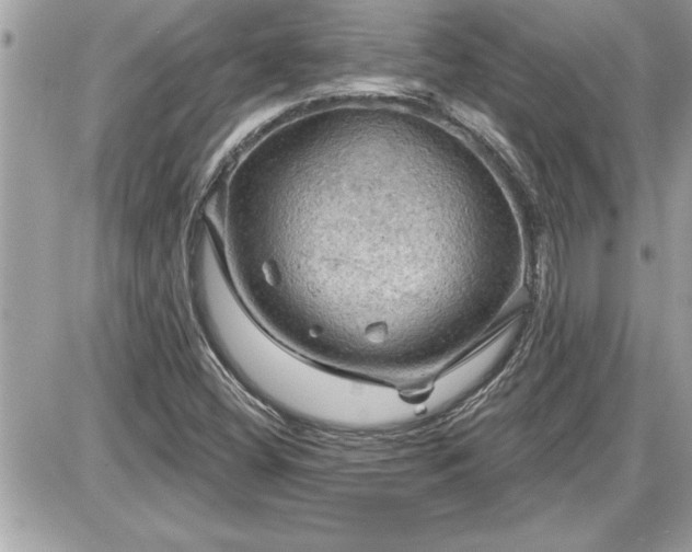 X0000087591404200705041457