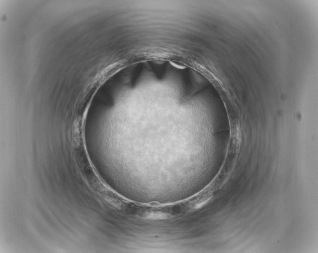 X0000087590360200705112309