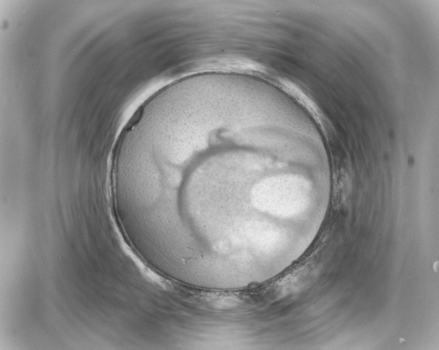 X0000087591103200705112257