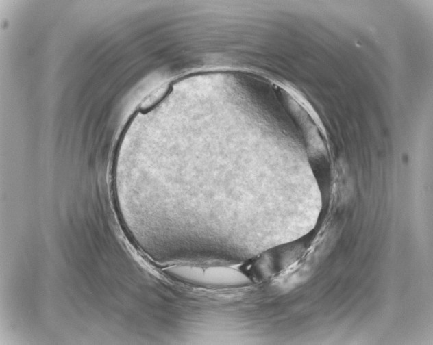 X0000087591197200705112255