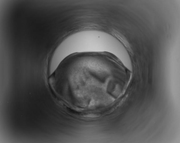 X0000087590058200705181226