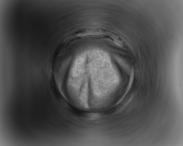 X0000087590085200705181227