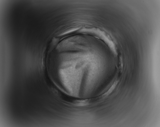 X0000087590170200705181226