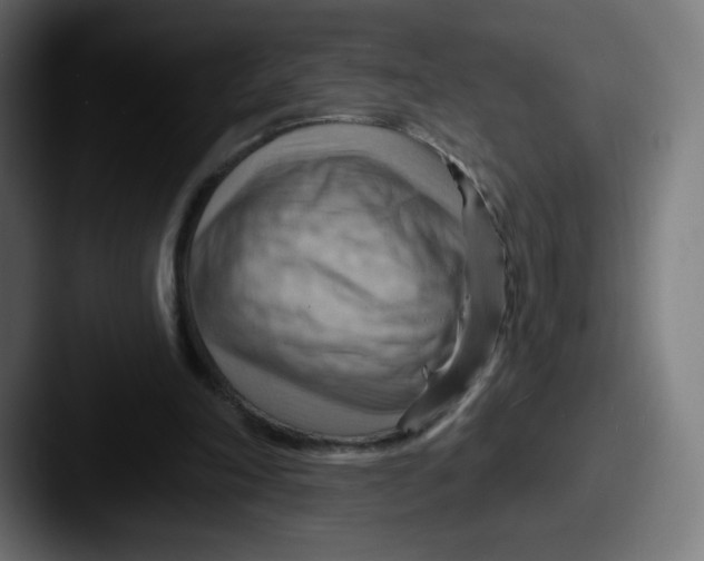 X0000087590198200705181225