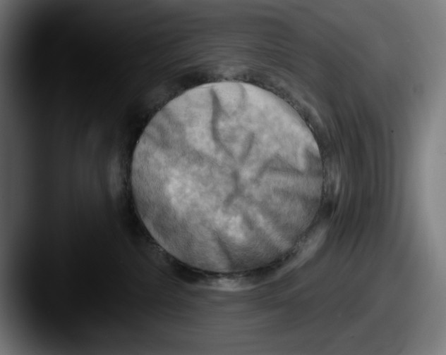 X0000087590236200705181225