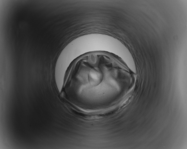 X0000087590239200705181225