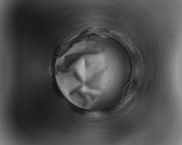 X0000087590282200705181224