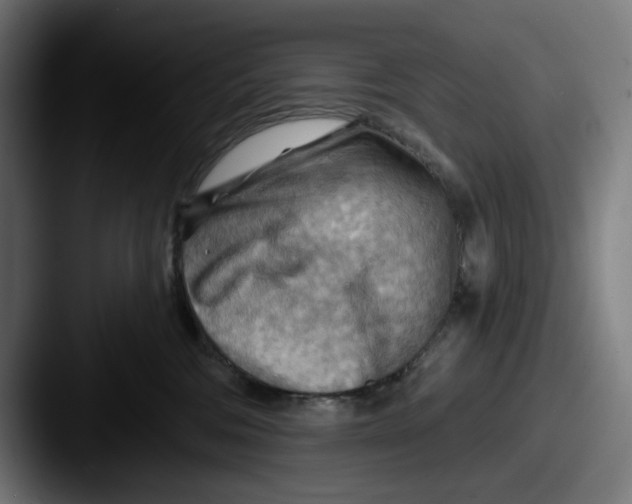 X0000087590330200705181223