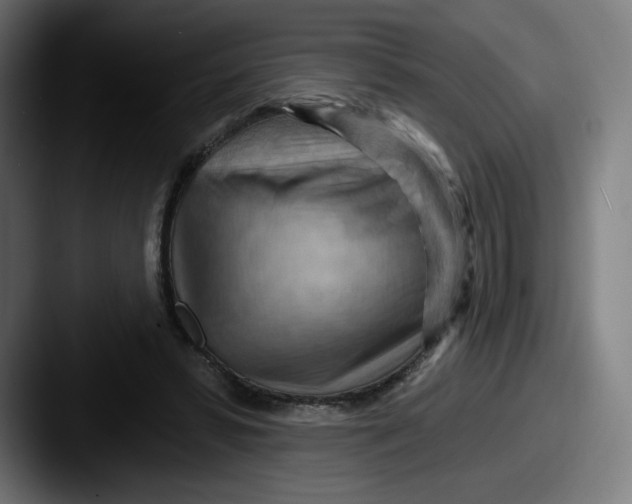 X0000087590399200705181223