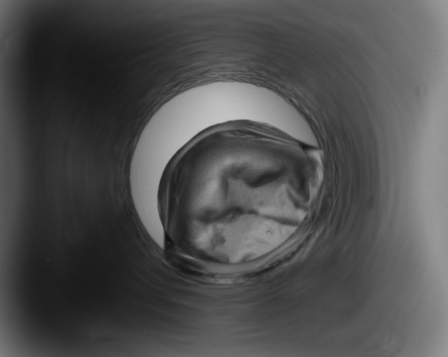 X0000087590432200705181222