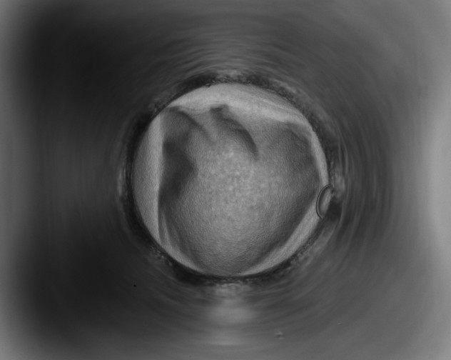 X0000087590468200705181222