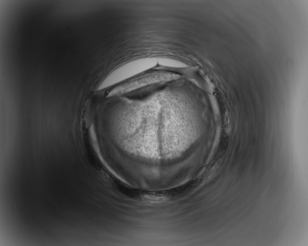 X0000087590515200705181221