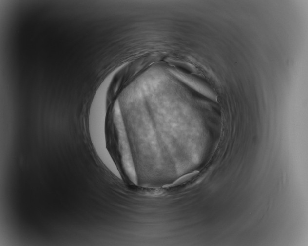 X0000087590576200705181221