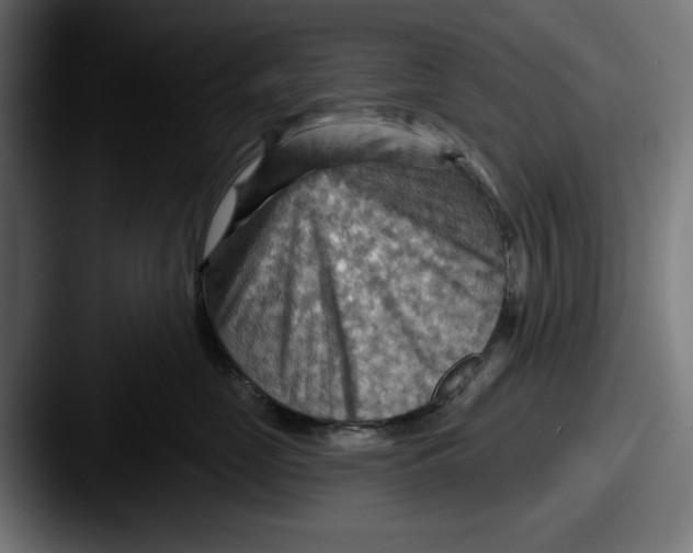 X0000087590669200705181220