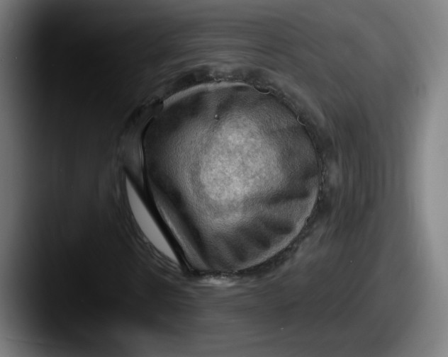 X0000087590914200705181216