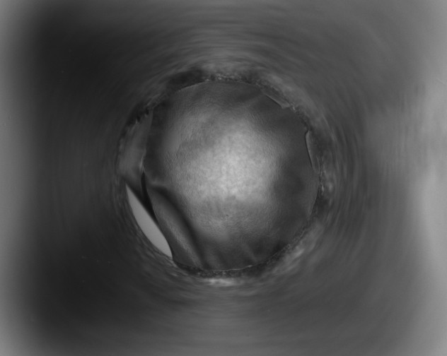 X0000087591010200705181215