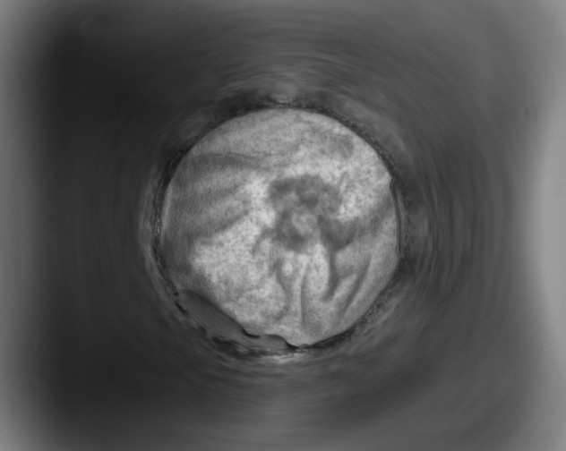 X0000087591105200705181214