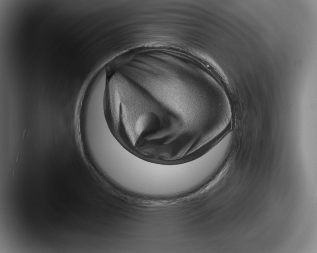 X0000087591122200705181214