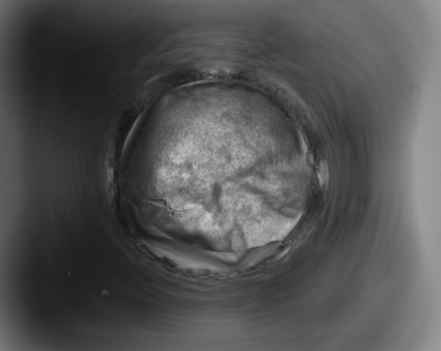 X0000087591396200705181210