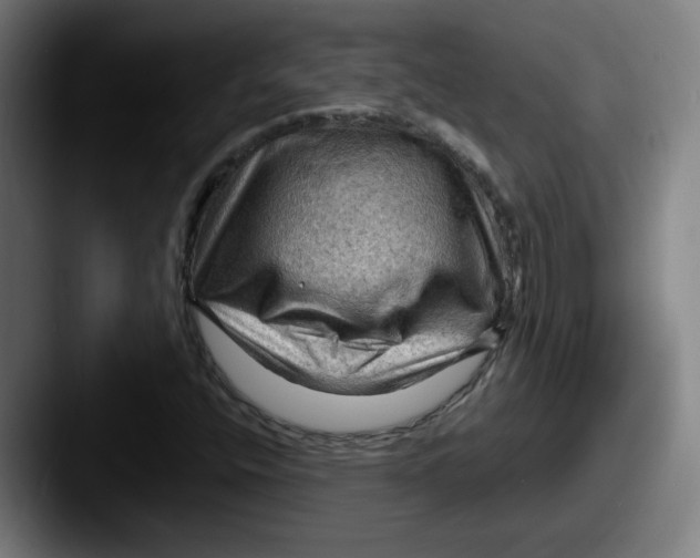 X0000087591400200705181211