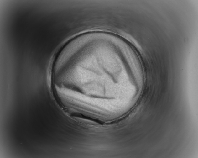 X0000087591504200705181209