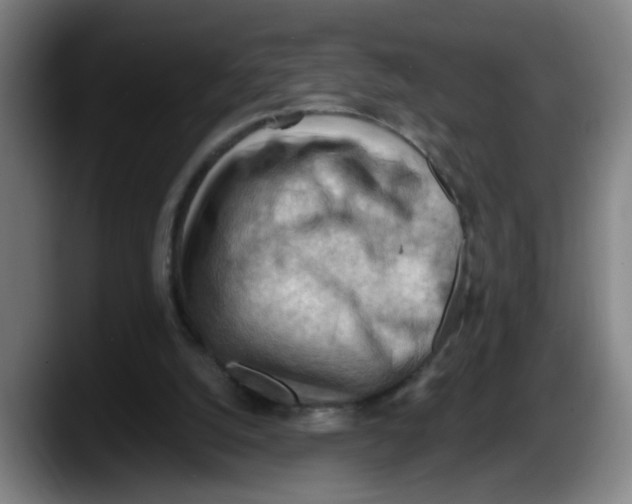 X0000087590056200705251910