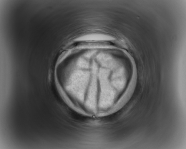 X0000087590071200705251910