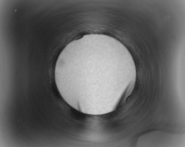 X0000087590079200705251910