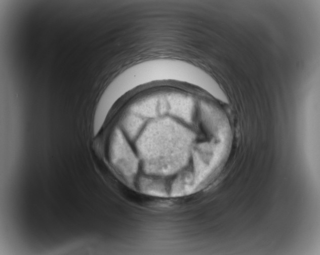 X0000087590086200705251910