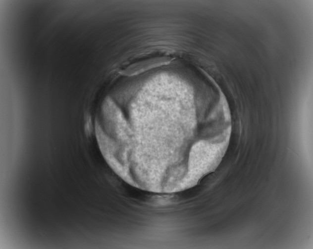 X0000087590089200705251910
