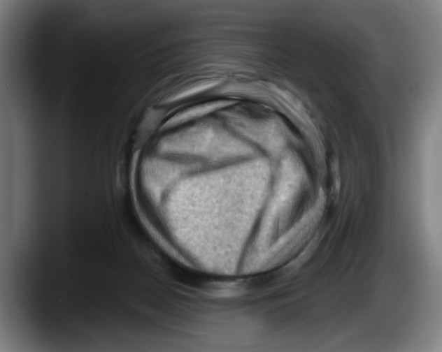 X0000087590170200705251909