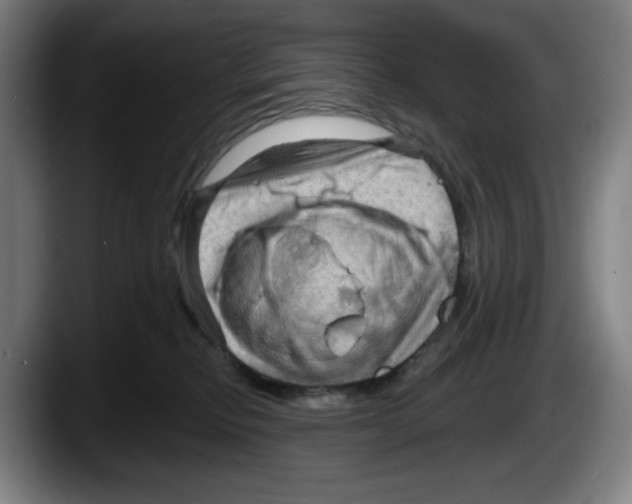 X0000087590278200705251908