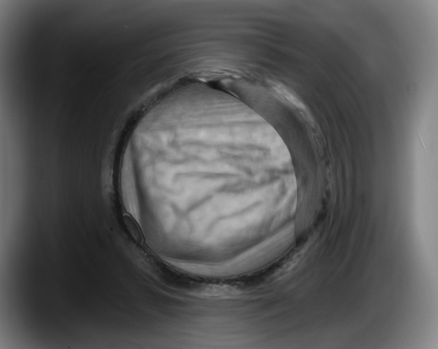X0000087590399200705251906