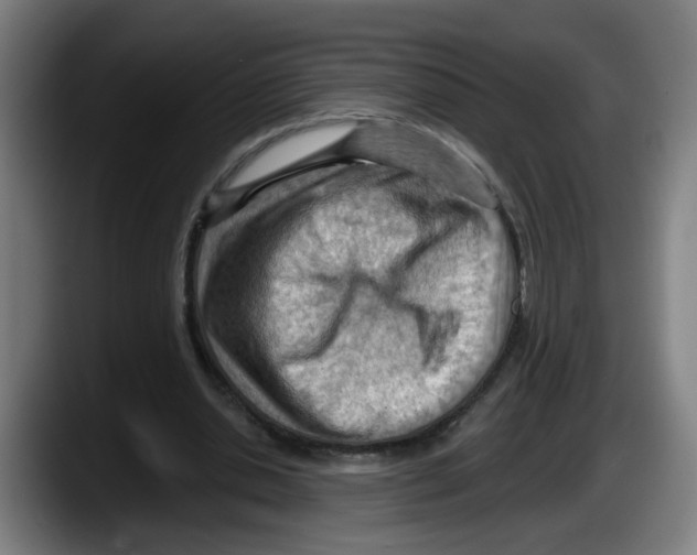 X0000087590438200705251905