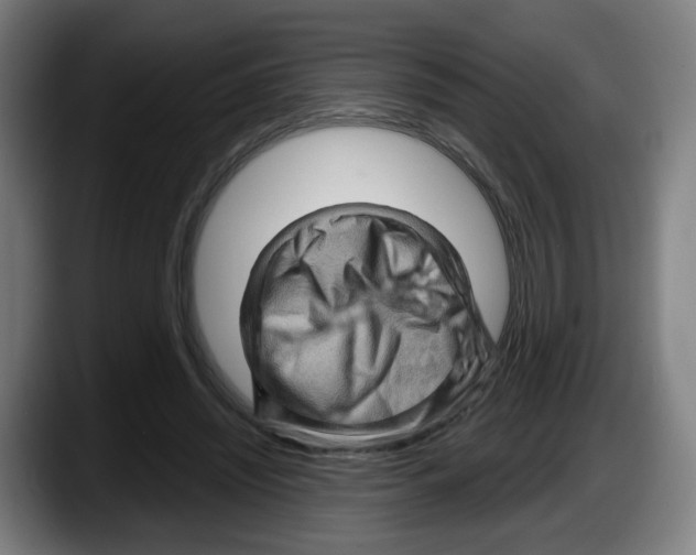 X0000087590444200705251905