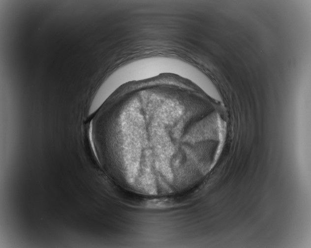 X0000087590461200705251905