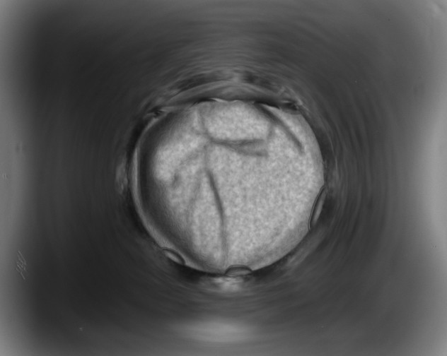 X0000087590478200705251905