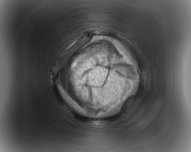 X0000087590657200705251902