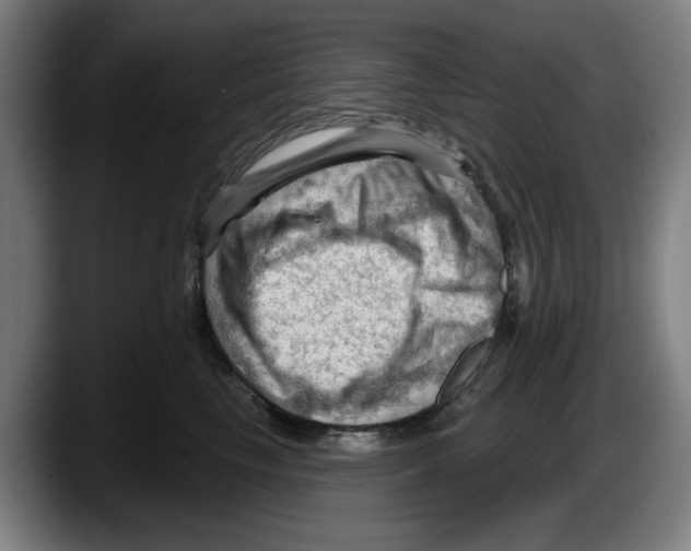 X0000087590665200705251903
