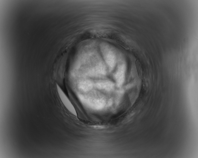 X0000087591010200705251857