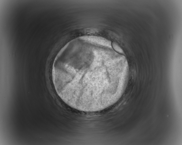 X0000087591393200705251852