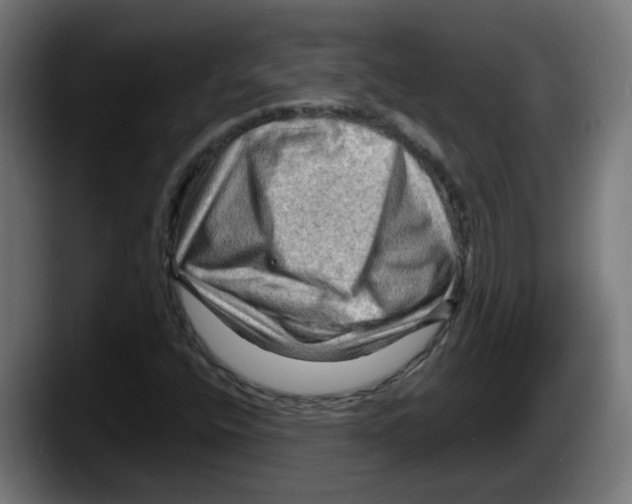 X0000087591400200705251852