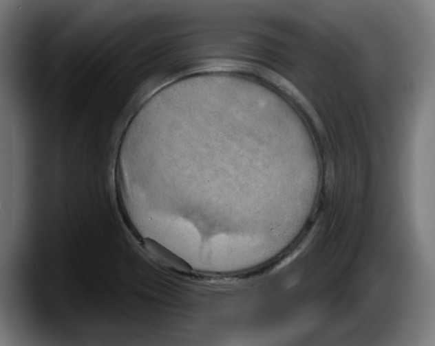 X0000087591417200705251852