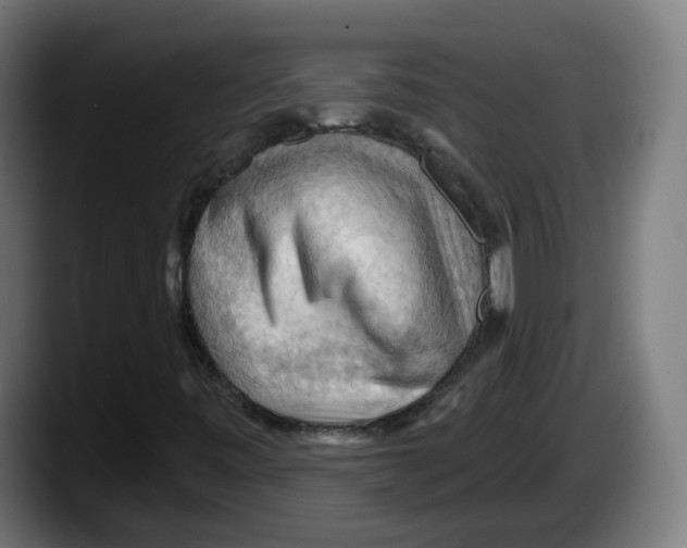 X0000087591443200705251852