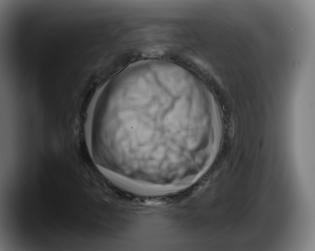 X0000087591445200705251852