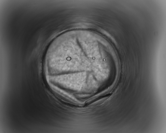 X0000087591459200705251852