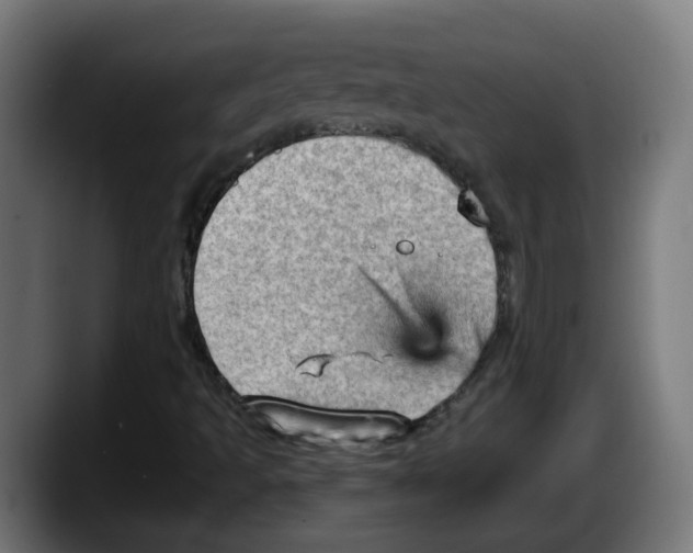 X0000087591493200705251851