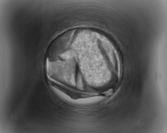 X0000087591505200705251851