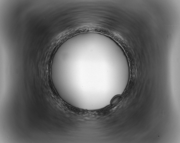 X0000087601062200704271039