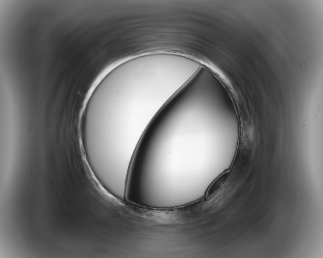 X0000087601102200704271039